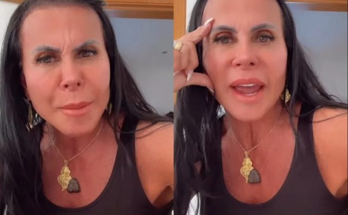 Gretchen expôs prints do vídeo onde um dentista chamou sua harmonização de "aberração facial" e criticou a atitude do profissional. (Foto: Instagram)