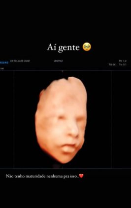 O ex-casal realizou um ultrassom 3D para ver o rosto da criança. (Foto: Instagram)