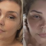 Simony surpreende fãs ao mostrar progresso no crescimento capilar após tratamento contra câncer (Foto: Instagram)