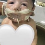 Bebê enfrentou malformações congênitas graves. (Foto: Instagram)