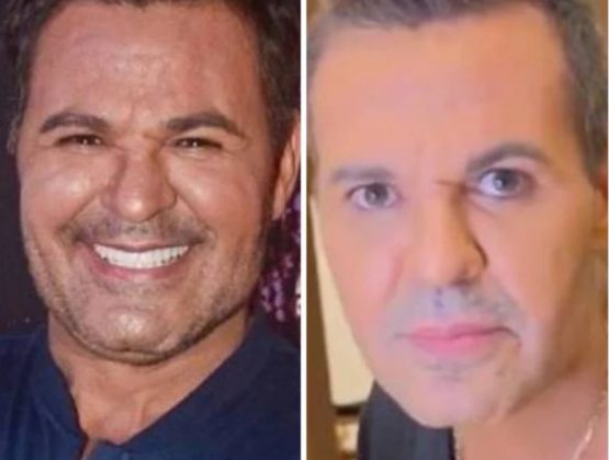 Fãs opinam sobre magreza do cantor, alguns expressando preocupação. (Foto: Instagram)