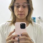 uma condição médica que afeta os músculos faciais, causando sintomas como dormência e dificuldade para movimentar o rosto. (Foto: Instagram)