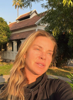 Ana Hickmann encoraja Birkheuer a se libertar da vergonha. (Foto: Instagram)