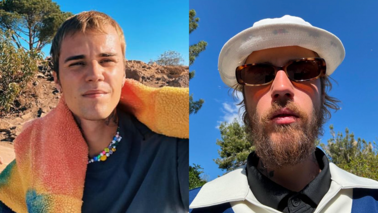 Justin Bieber surpreende ao surgir com novo visual (Foto: Instagram)