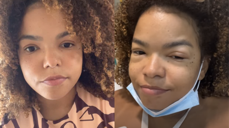 Jeniffer Nascimento tranquiliza fãs após reação alérgica a lagosta: "Estou bem melhor" (Foto: Instagram)