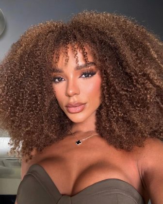Bruna Gonçalves faz cirurgia de frontoplastia e realiza sonho (Foto: Instagram)