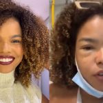 Jeniffer Nascimento desabafa após assustar fãs com reação alérgica: "Desesperador". (Foto: Instagram)