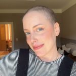 A leucemia começou como crônica e evoluiu para aguda. (Foto: Instagram)