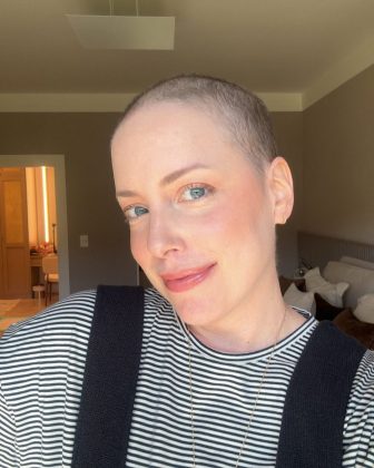 A leucemia começou como crônica e evoluiu para aguda. (Foto: Instagram)