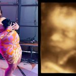 Tati Machado mostra ultrassom do filho: "Ele está muito grande" (Foto: Instagram)