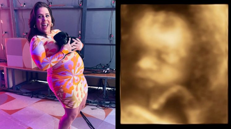 Tati Machado mostra ultrassom do filho: "Ele está muito grande" (Foto: Instagram)