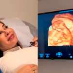 Maira Cardi mostra primeira ultrassom. (Foto: Instagram)