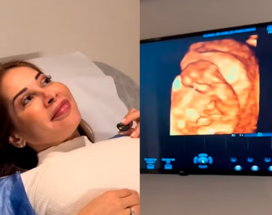 Maira Cardi mostra primeira ultrassom. (Foto: Instagram)