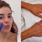 Precisa mesmo? Gkay faz harmonização nas mãos com dermatologista das Kardashians (Foto: Instagram)