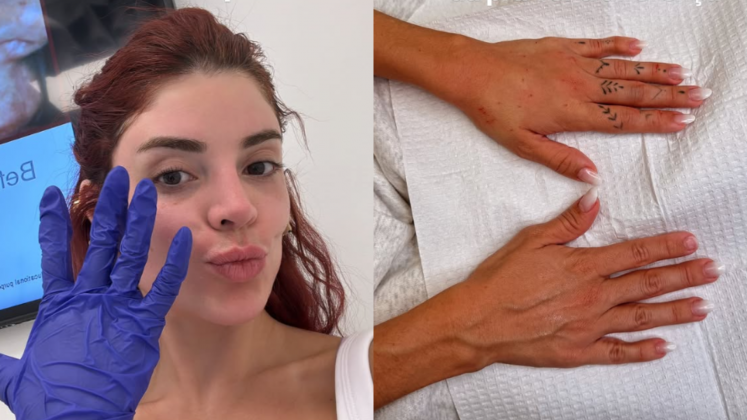 Precisa mesmo? Gkay faz harmonização nas mãos com dermatologista das Kardashians (Foto: Instagram)