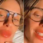 Carolina Dieckmann sofre reação alérgica após voo. (Foto: Instagram)