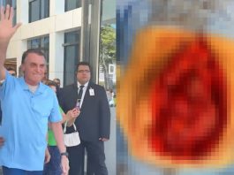 Bolsonaro é detonado após postar barriga aberta com intestino à mostra: "Maluco" (Foto: Instagram)