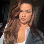 Juliette sofre acidente doméstico e mostra como ficou o rosto após o ocorrido (Foto: Instagram)