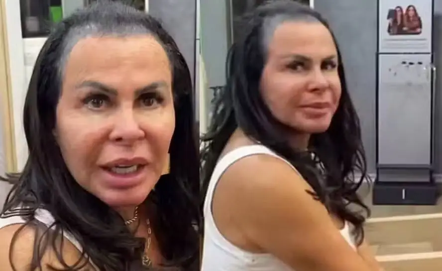 Gretchen fala sobre doença e busca pela autoaceitação: "Não tenho mais cabelo" (Foto: Instagram)