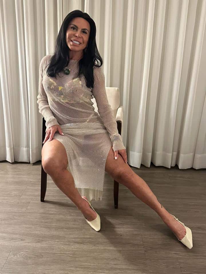 Gretchen disse que espera poder incentivar outras mulheres que se sentem incomodadas com a perda dos fios a buscar ajuda. (Foto: Instagram)