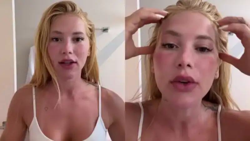 Virginia Fonseca assusta seguidores ao surgir com rosto inchado e se explica (Foto: Instagram)