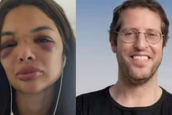 “Meu maior medo era ser morta”: dentista relata agressões e histórico de violência do marido
