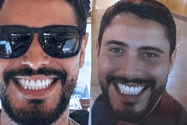 Dentista é acusado de transmitir HIV de propósito para mulheres com quem se relacionava