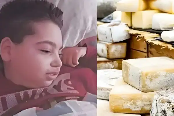 Adolescente morre nove anos após consumir queijo contaminado na infância