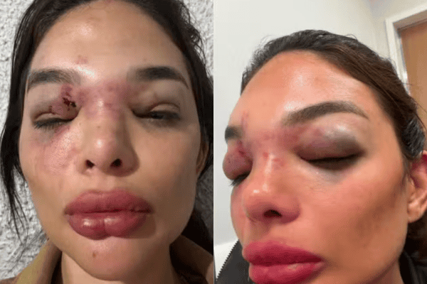 “Seguranças não prestaram socorro”, diz dentista após agressão do ex-marido