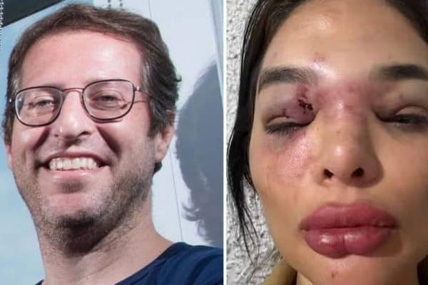 Empresário é preso após mulher denunciar socos, agressões com taco e ameaça com arma de choque