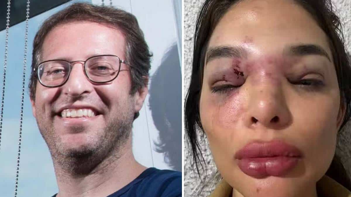 Empresário é preso após mulher denunciar socos, agressões com taco e ameaça com arma de choque (Foto: Instagram)