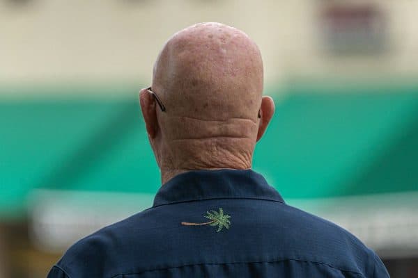 Homem paga R$ 15 mil por transplante capilar, recebe metade do tratamento e vai à Justiça