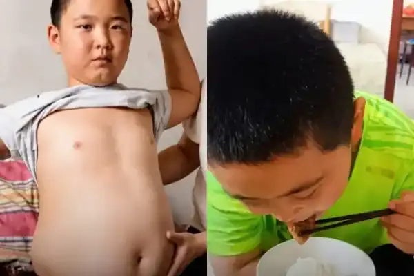 Menino de 11 anos engorda para poder doar medula óssea e tentar salvar o pai com leucemia