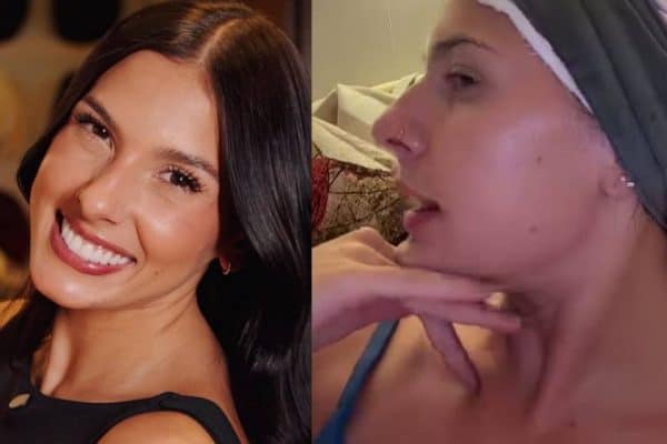 Ana Castela revela o detalhe do rosto que a incomoda: “Quero muito fazer”