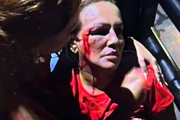 Iara Pimentel é atingida durante carreata política em Minas Gerais