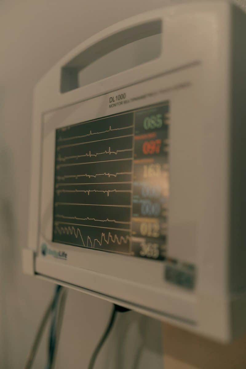 Close-up of a medical monitor displaying vital signs